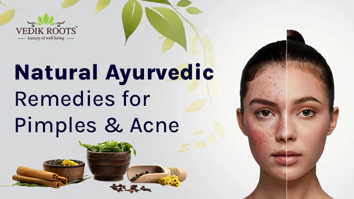 Pimple vs Acne: 7 Simple Home Remedies & Treatment