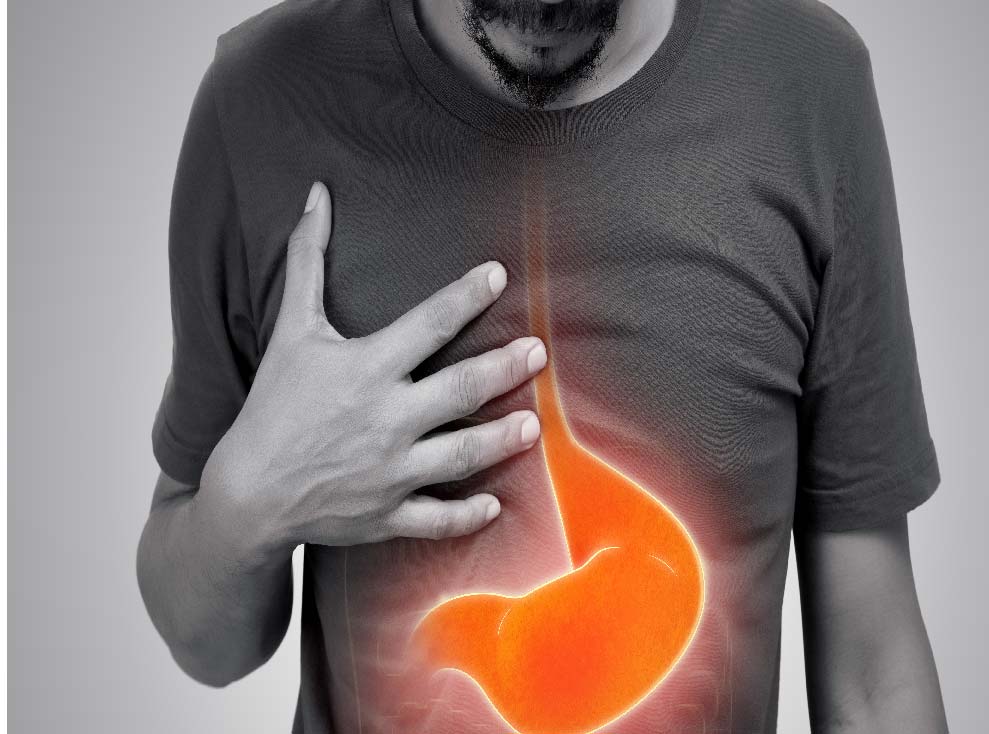 Manage gastric Issues